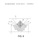 COMB FOR TREATING PEDICULOSIS diagram and image