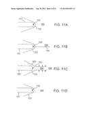 Shock Wave Modification Method and System diagram and image