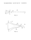 Shock Wave Modification Method and System diagram and image