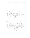 Shock Wave Modification Method and System diagram and image