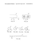 Shock Wave Modification Method and System diagram and image