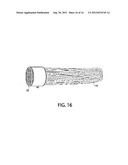 Fluoropolymer hollow fiber membrane with fluoro-copolymer and     fluoro-terpolymer bonded end portion(s) and method to fabricate diagram and image