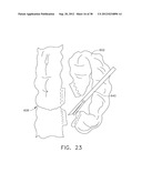 COLLAPSIBLE ANVIL PLATE ASSEMBLIES FOR CIRCULAR SURGICAL STAPLING DEVICES diagram and image