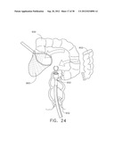 COLLAPSIBLE ANVIL PLATE ASSEMBLIES FOR CIRCULAR SURGICAL STAPLING DEVICES diagram and image