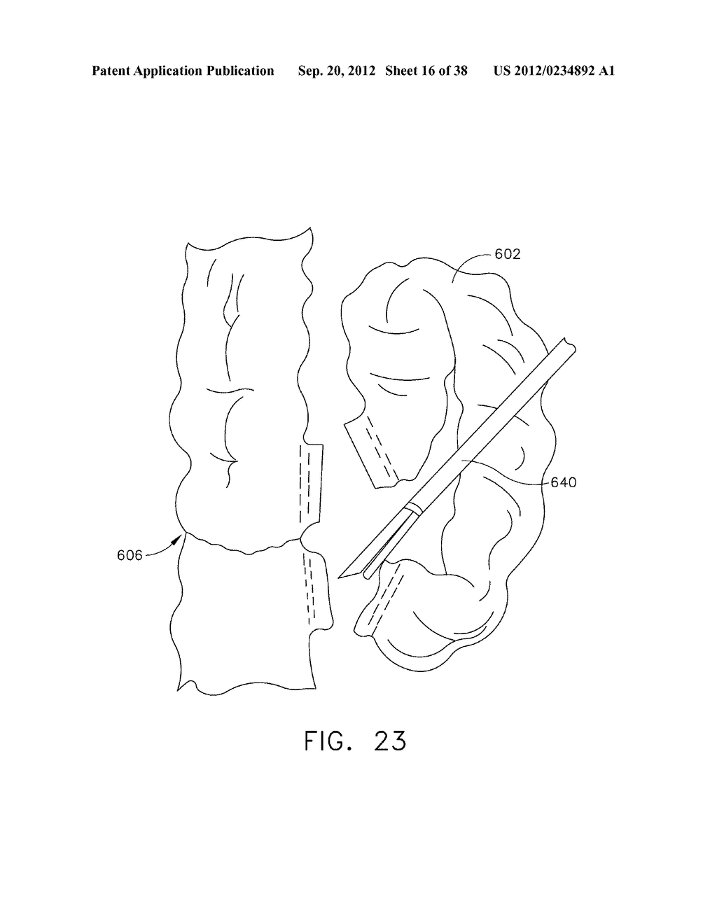 MULTIPLE PART ANVIL ASSEMBLIES FOR CIRCULAR SURGICAL STAPLING DEVICES - diagram, schematic, and image 17