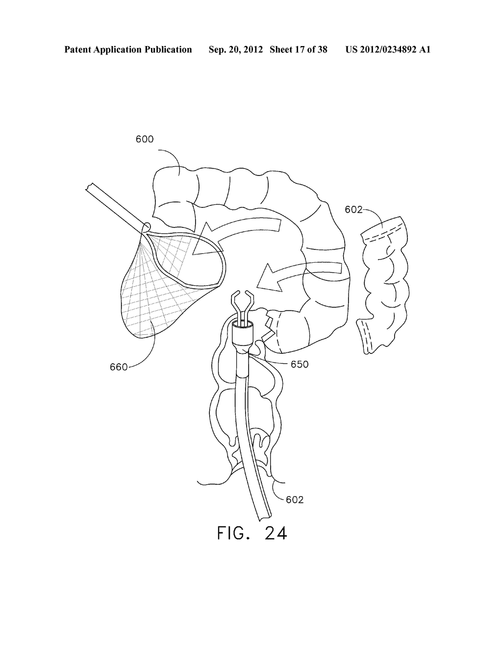 MULTIPLE PART ANVIL ASSEMBLIES FOR CIRCULAR SURGICAL STAPLING DEVICES - diagram, schematic, and image 18