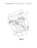 FLAT FAN AIR ASSIST INJECTORS diagram and image