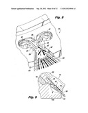 FLAT FAN AIR ASSIST INJECTORS diagram and image