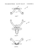 Lid Holder diagram and image