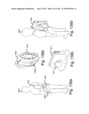 MULTI-RESONATOR WIRELESS ENERGY TRANSFER FOR MEDICAL APPLICATIONS diagram and image