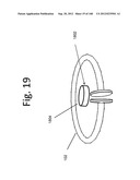 MULTI-RESONATOR WIRELESS ENERGY TRANSFER FOR MEDICAL APPLICATIONS diagram and image