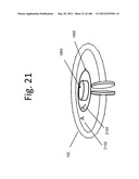 MULTI-RESONATOR WIRELESS ENERGY TRANSFER FOR MEDICAL APPLICATIONS diagram and image