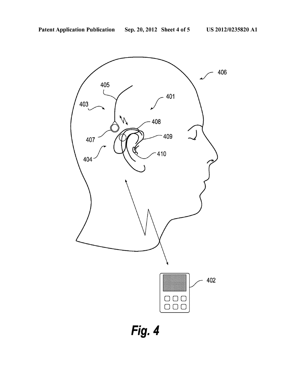 METHOD AND APPARATUS FOR ALERTING A PERSON CARRYING AN EEG ASSEMBLY - diagram, schematic, and image 05