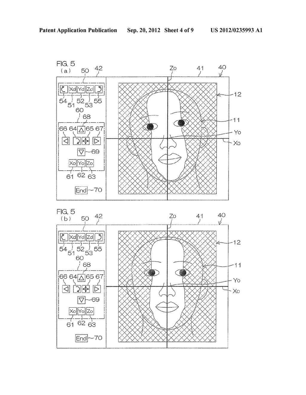 Display Orientation Adjustment Device And Adjustment Program For Medical     Three-Dimensional Image - diagram, schematic, and image 05