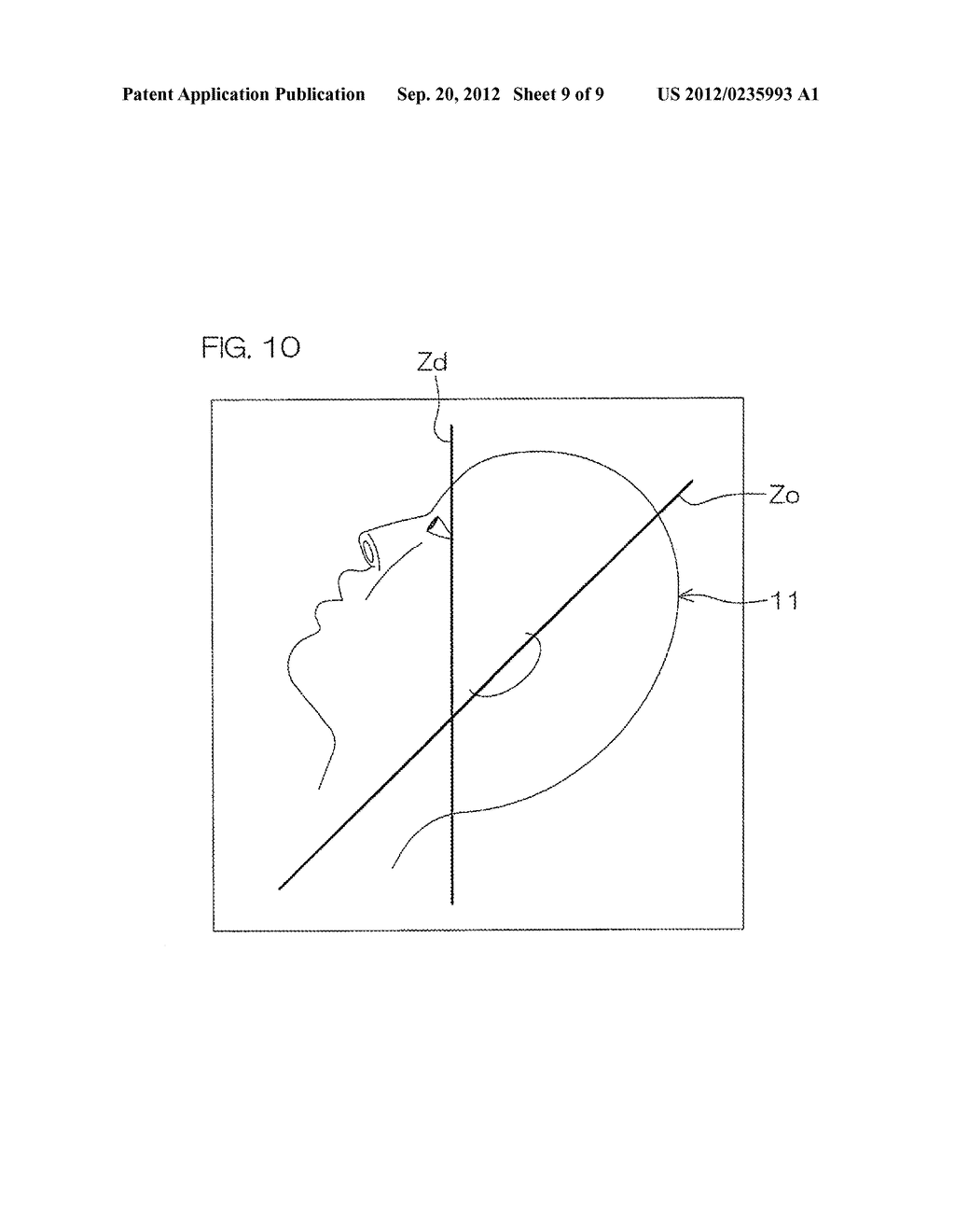 Display Orientation Adjustment Device And Adjustment Program For Medical     Three-Dimensional Image - diagram, schematic, and image 10