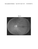 AUTOMATED DETERMINATION OF ARTERIOVENOUS RATIO IN IMAGES OF BLOOD VESSELS diagram and image