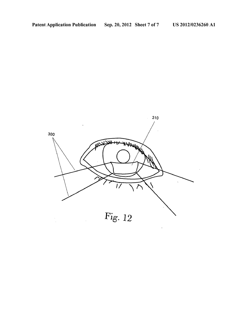 TEAR FILM MEASUREMENT - diagram, schematic, and image 08