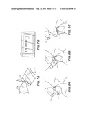 COMPUTED RADIOGRAPHY SCANNER AND ENVELOPE FOR IMAGING PLATES diagram and image