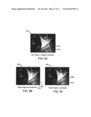 ROBUST SPARSE IMAGE MATCHING FOR ROBOTIC SURGERY diagram and image