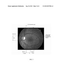 METHOD AND SYSTEM FOR THE DIAGNOSIS OF DISEASE USING RETINAL IMAGE CONTENT     AND AN ARCHIVE OF DIAGNOSED HUMAN PATIENT DATA diagram and image