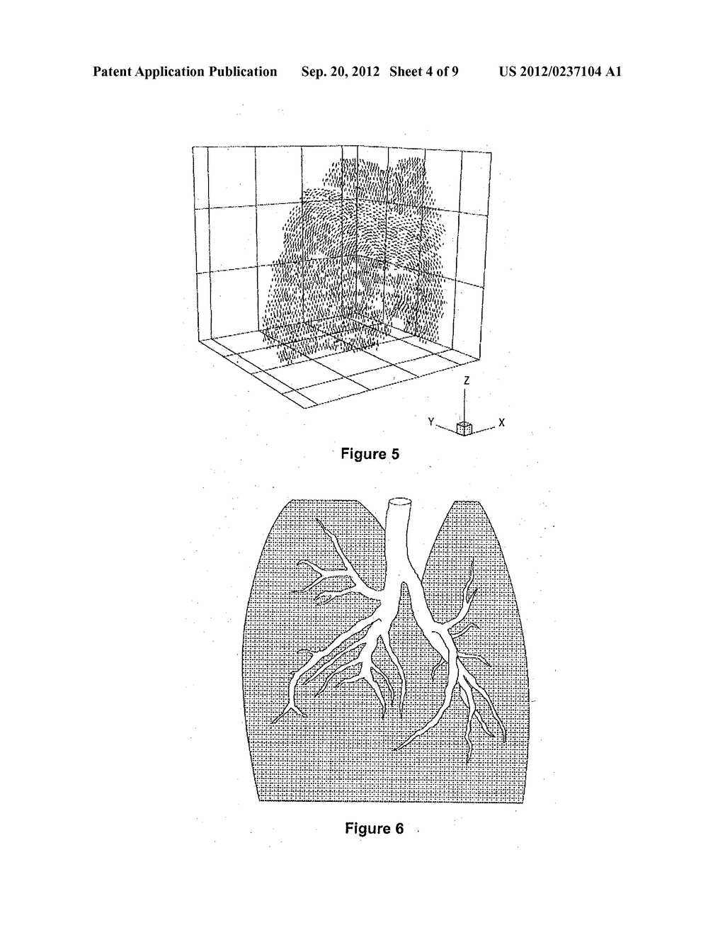 PARTICLE IMAGE VELOCIMETRY SUITABLE FOR X-RAY PROJECTION IMAGING - diagram, schematic, and image 05