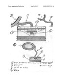 Flatch Evac diagram and image