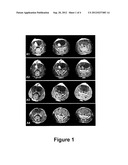 Oncolytic Virotherapy for Prevention of Tumor Recurrence diagram and image