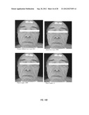 METHOD OF TREATMENT USING SOLUBILIZED PROTEIN COMPOSITION OBTAINED FROM     EGGSHELL MEMBRANE diagram and image