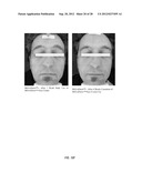 METHOD OF TREATMENT USING SOLUBILIZED PROTEIN COMPOSITION OBTAINED FROM     EGGSHELL MEMBRANE diagram and image