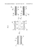 PROCESS FOR FORMING A DOUBLE-SIDED SHAPED FOAM ARTICLE diagram and image