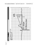 12-LEAD ELECTROCARDIOGRAM ONLINE-LEARNING SYSTEM diagram and image