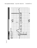 12-LEAD ELECTROCARDIOGRAM ONLINE-LEARNING SYSTEM diagram and image