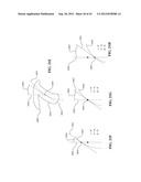 CONTINUOUSLY VARIABLE TRANSMISSION diagram and image