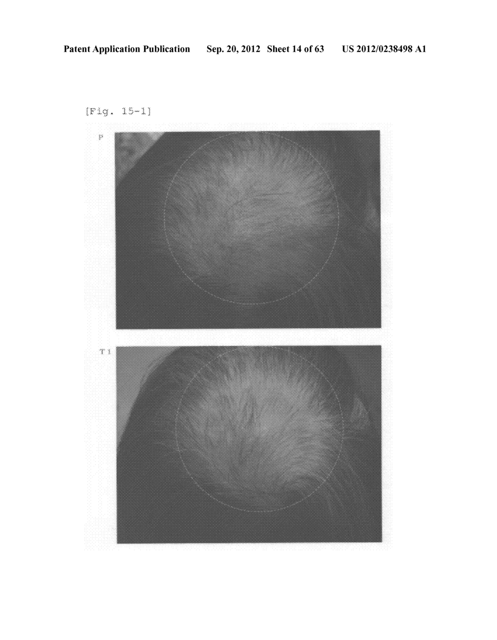 Agent for the treatment of alopecia - diagram, schematic, and image 15