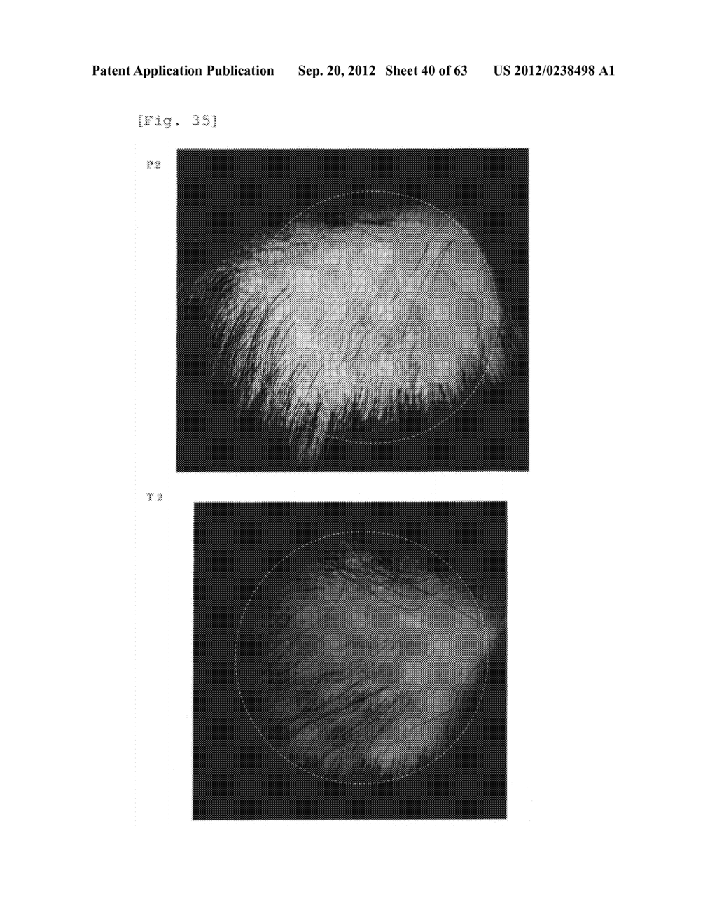 Agent for the treatment of alopecia - diagram, schematic, and image 41