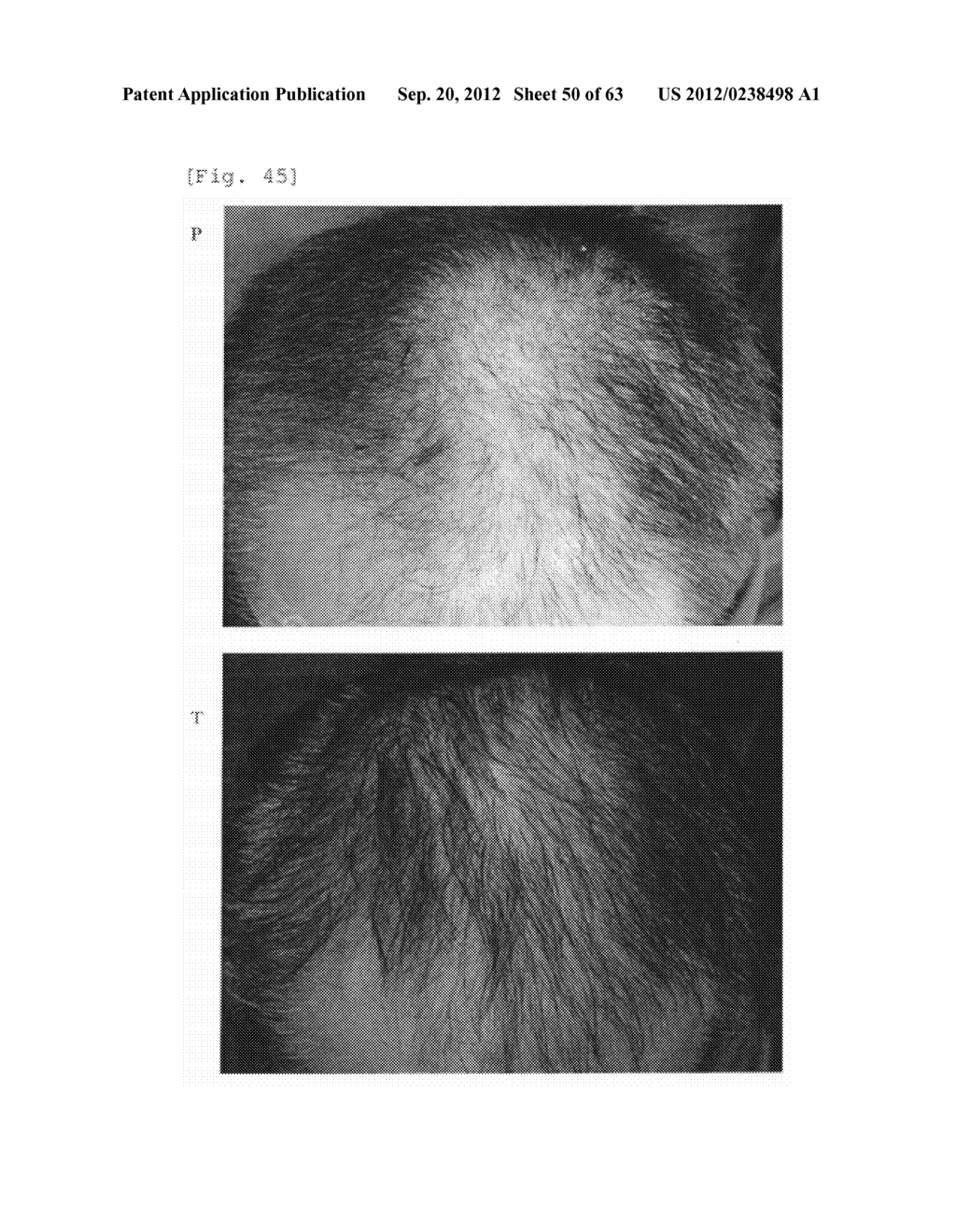 Agent for the treatment of alopecia - diagram, schematic, and image 51