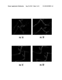 Compositions and Methods for the Treatment of Musculoskeletal Related     Diseases and Disorders Using Metal Ion-Citrate Analog Complexes diagram and image