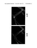 Compositions and Methods for the Treatment of Musculoskeletal Related     Diseases and Disorders Using Metal Ion-Citrate Analog Complexes diagram and image