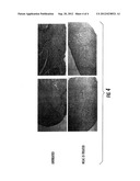 Compositions and Methods for the Treatment of Musculoskeletal Related     Diseases and Disorders Using Metal Ion-Citrate Analog Complexes diagram and image