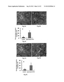 USE OF CELL AUTOPHAGY (TYPE II CELL APOPTOSIS) INHIBITORS diagram and image