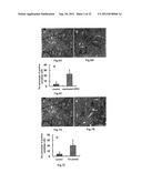 USE OF CELL AUTOPHAGY (TYPE II CELL APOPTOSIS) INHIBITORS diagram and image