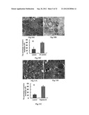 USE OF CELL AUTOPHAGY (TYPE II CELL APOPTOSIS) INHIBITORS diagram and image