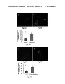 USE OF CELL AUTOPHAGY (TYPE II CELL APOPTOSIS) INHIBITORS diagram and image