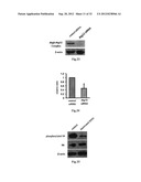 USE OF CELL AUTOPHAGY (TYPE II CELL APOPTOSIS) INHIBITORS diagram and image