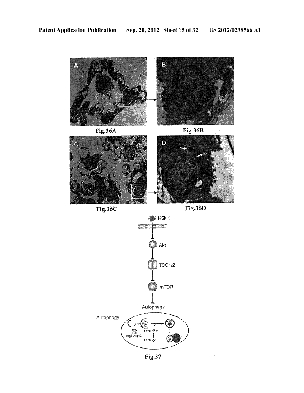 USE OF CELL AUTOPHAGY (TYPE II CELL APOPTOSIS) INHIBITORS - diagram, schematic, and image 16