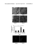 USE OF CELL AUTOPHAGY (TYPE II CELL APOPTOSIS) INHIBITORS diagram and image