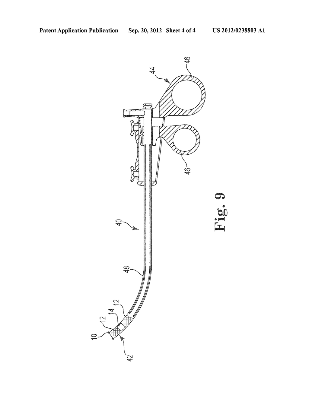 Urethral Stent System and Method - diagram, schematic, and image 05