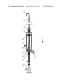 ENDOSCOPE diagram and image