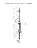 ENDOSCOPE diagram and image