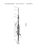 ENDOSCOPE diagram and image